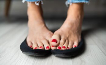 Smelly feet are not just a social problem.  They may signal health problems