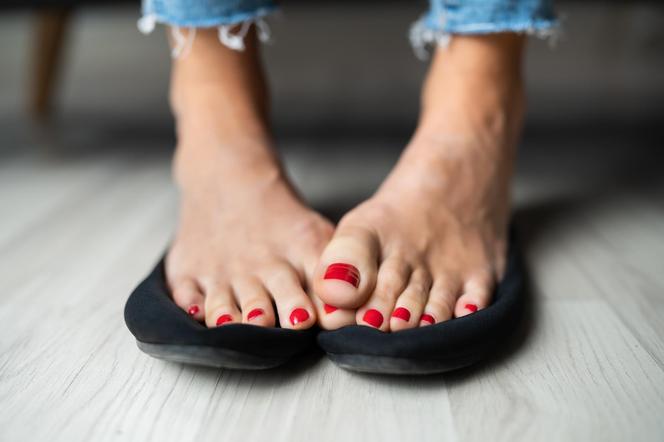 Smelly feet are not just a social problem.  They may signal health problems
