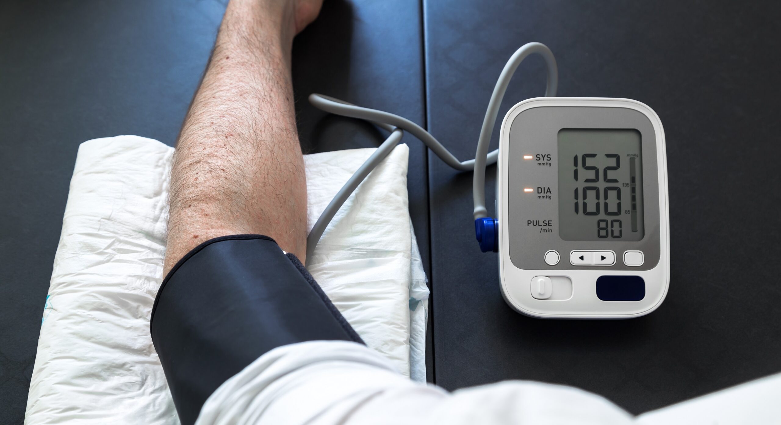 High blood pressure: This risk factor is often underestimated