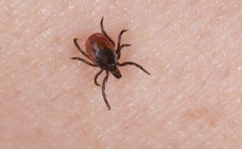 How to avoid tick bites and remove ticks properly