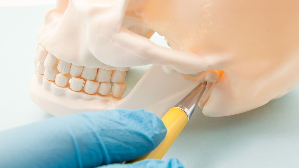 Maxillary fracture: what treatment?