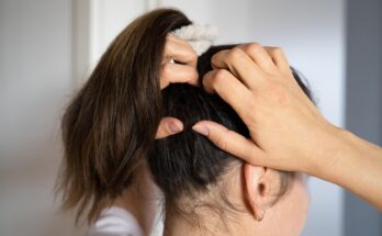 The itchy scalp drives me "crazy".  What could be the source of this problem?