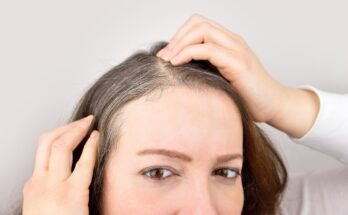 They become oily, gray and fall out.  Deficiency of this vitamin is a big problem for hair