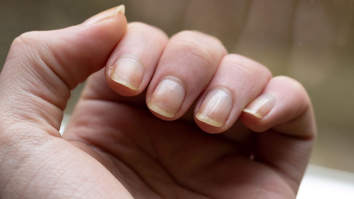 This abnormality on your nails could be a sign of cancer, according to a new study