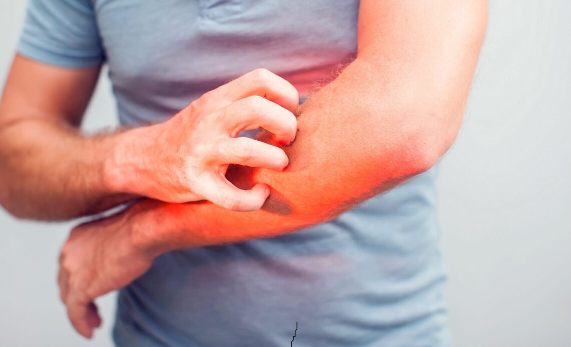 Itching: Common causes and countermeasures