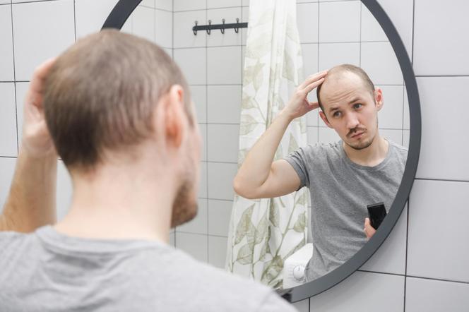 A Case That Could Change a Lot: Scientists Have a New Possible Method for Balding