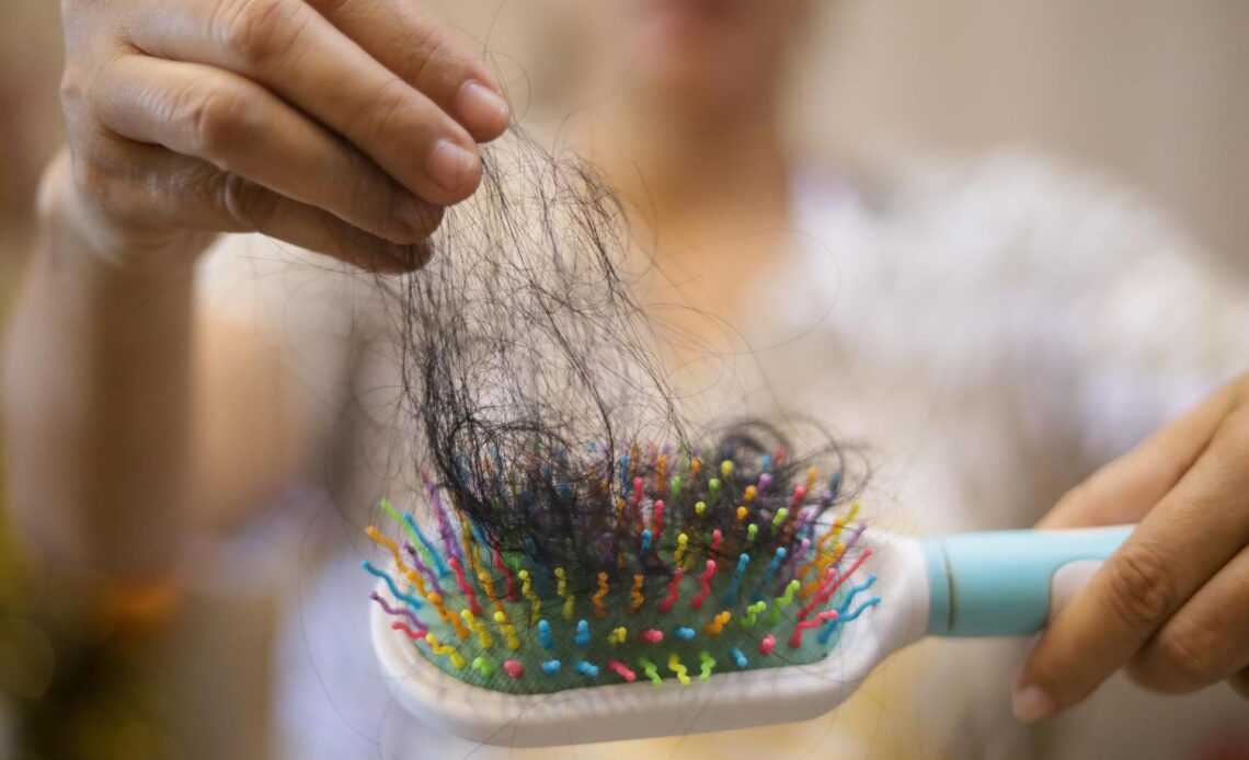 Hairdresser has a solution to a popular problem. Stop hair loss