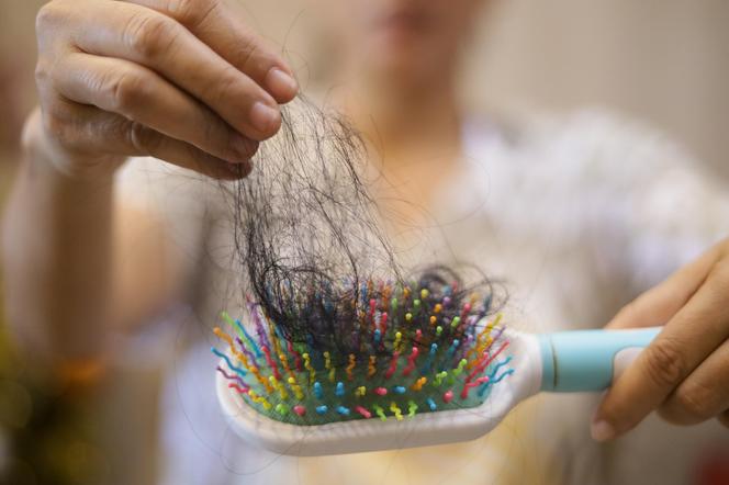 Hairdresser has a solution to a popular problem. Stop hair loss