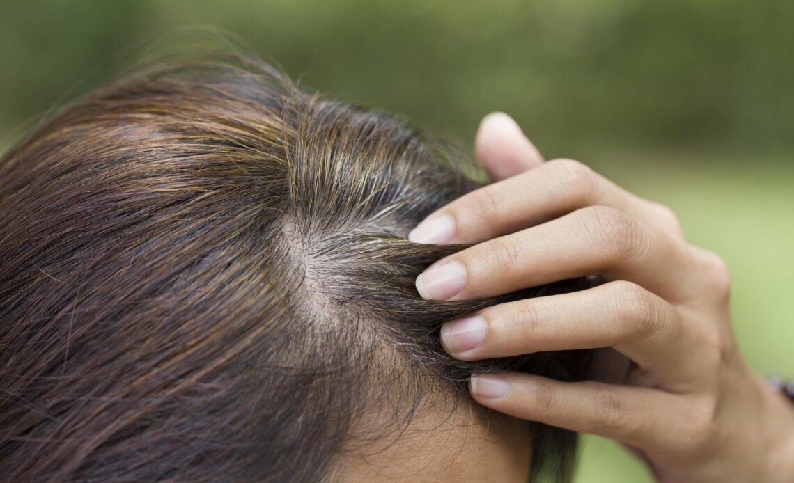 You don't have to go gray once and for all. Premature graying can be reversed