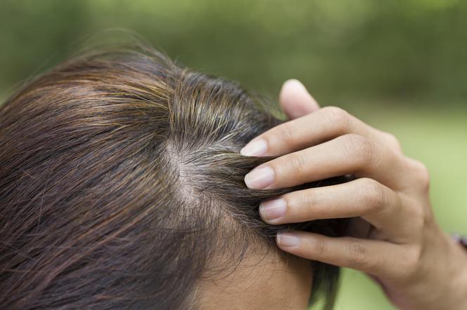 You don't have to go gray once and for all. Premature graying can be reversed